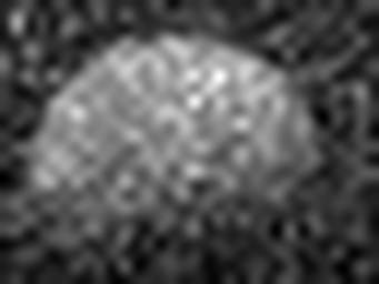 1489061855_1 @ 5 µm