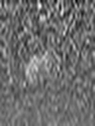 1492218304_1 @ 5 µm