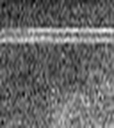 1516292774_1 @ 5 µm