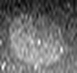 1558911553_1 @ 5 µm