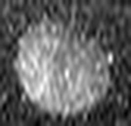 1558912309_1 @ 5 µm