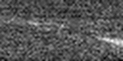 1561410331_1 @ 5 µm