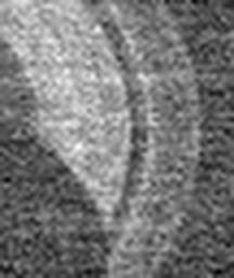 1845071816_1 @ 5 µm