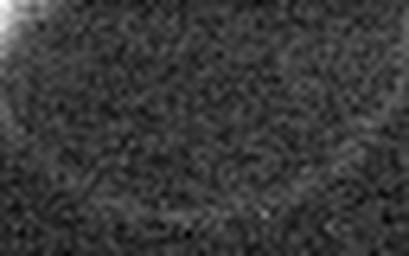 1544588507_1 @ 5 µm