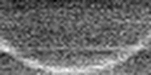 1616843394_1 @ 5 µm