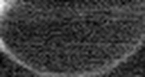 1616846369_1 @ 5 µm