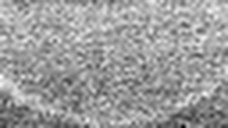 1620236020_1 @ 5 µm