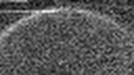 1752132732_1 @ 5 µm